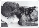 Head and chest of the mummy found in the pyramid of Merenre I at Saqqara.